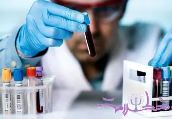 بهترین نوشیدنی برای کاهش کلسترول و چربی خون 