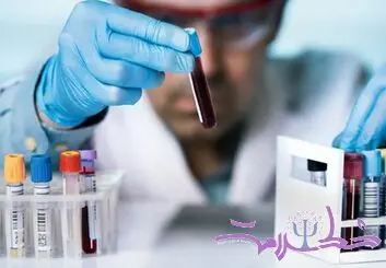 بهترین نوشیدنی برای کاهش کلسترول و چربی خون 