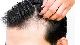 ژل بیوتین را در خانه تهیه کنید+موهای تان پر پشت می شود