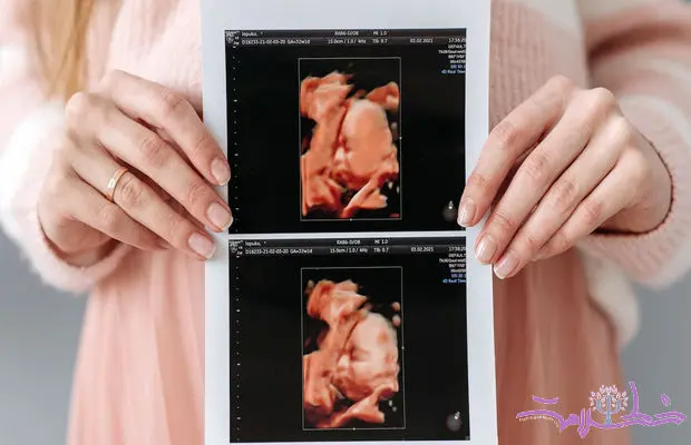هشدار جدی به زنان باردار / نوزاد بدون کبد و یا مغز کوچک به دنیا نیاورید!