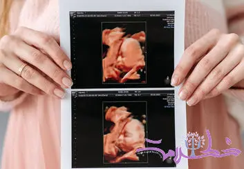 هشدار جدی به زنان باردار / نوزاد بدون کبد و یا مغز کوچک به دنیا نیاورید!