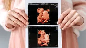 هشدار جدی به زنان باردار / نوزاد بدون کبد و یا مغز کوچک به دنیا نیاورید!