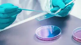 چگونه  روده از شما در برابر عفونت لیستریا محافظت می کند؟
