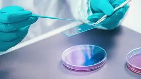 چگونه  روده از شما در برابر عفونت لیستریا محافظت می کند؟