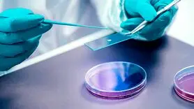 لیستریا چیست؟/  بررسی راههای انتقال لیستریا و افراد در معرض خطر