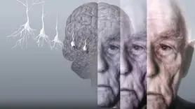 علائم اولیه آلزایمر از دهان و دندان شروع می شود !