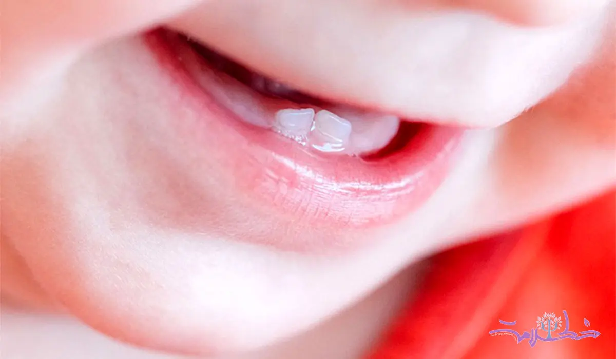 سرشیشه و پستانک‌ با دندان کودک چه می کند؟