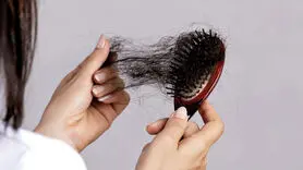 6 دلیل اصلی ریزش مو + راهکار