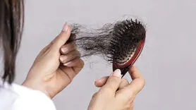 6 دلیل اصلی ریزش مو + راهکار