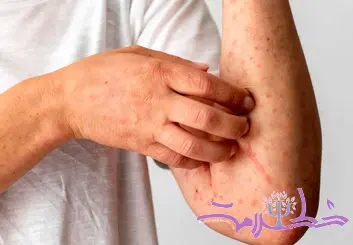  11 علامت مهم آسیب کبدی که نباید نادیده بگیرید