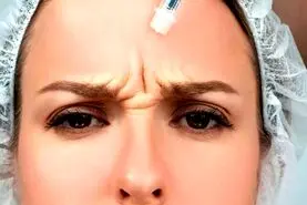 قبل از زدن بوتاکس این کار را انجام دهید تا تاثیرش بیشتر شود